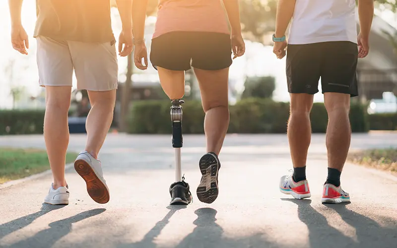 people walking with prosthetic leg